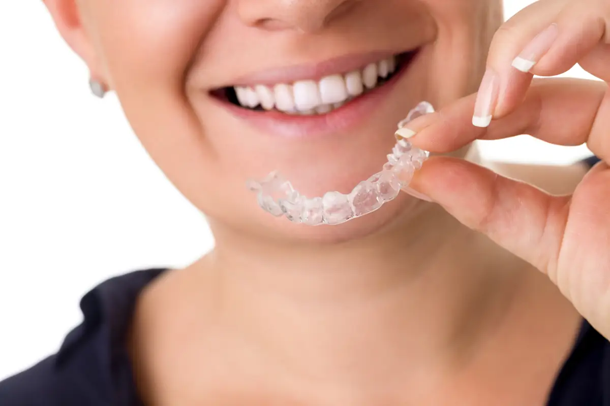 ortodoncia invisible Ortodoncia invisible En Clínica Dental Preboca